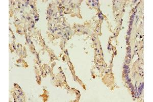 Immunohistochemistry of paraffin-embedded human lung tissue using ABIN7142610 at dilution of 1:100 (MTHFS Antikörper  (AA 2-203))