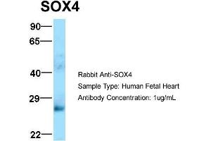 Host: Rabbit  Target Name: SOX4  Sample Tissue: Human Fetal Heart  Antibody Dilution: 1. (SOX4 Antikörper  (N-Term))