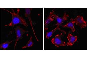 Confocal immunofluorescence analysis of SKBR-3 (left) and A549 (right) cells using beta Actin mouse mAb (red, the secondary Ab is Cy3-Goat anti mouse IgG). (beta Actin Antikörper)