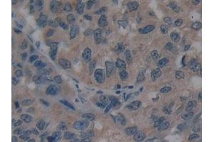 Immunohistochemistry (IHC) image for anti-Villin 1 (VIL1) (AA 1-320) antibody (ABIN7435034)