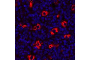 Immunofluorescence (IF) image for anti-CD68 Molecule (CD68) antibody (ABIN7449045) (Rekombinanter CD68 Antikörper)
