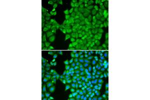 Immunofluorescence analysis of HeLa cell using CA3 antibody.