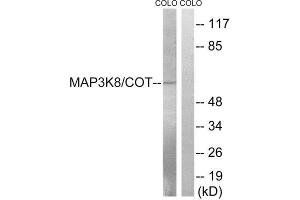 Western Blotting (WB) image for anti-Mitogen-Activated Protein Kinase Kinase Kinase 8 (MAP3K8) (Ser400) antibody (ABIN1848231) (MAP3K8 Antikörper  (Ser400))