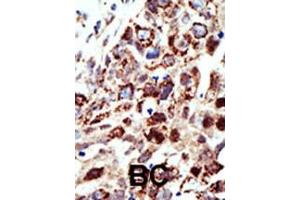 Immunohistochemistry (Paraffin-embedded Sections) (IHC (p)) image for anti-Signal Transducing Adaptor Molecule (SH3 Domain and ITAM Motif) 1 (STAM) (AA 326-356), (C-Term) antibody (ABIN388974)