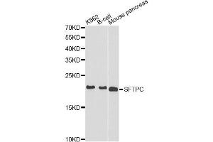 Western blot analysis of extracts of various cell lines, using SFTPC antibody. (Surfactant Protein C Antikörper)