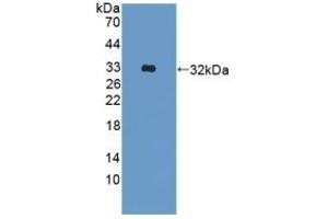 Detection of Recombinant ADAM33, Human using Polyclonal Antibody to A Disintegrin And Metalloprotease 33 (ADAM33) (ADAM33 Antikörper  (AA 210-503))