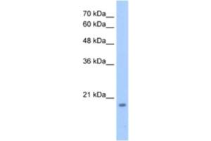 Western Blotting (WB) image for anti-Deoxynucleotidyltransferase, Terminal, Interacting Protein 1 (DNTTIP1) antibody (ABIN2463366) (DNTTIP1 Antikörper)