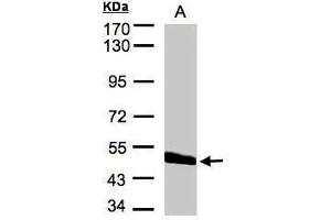 WB Image Sample(30 μg of whole cell lysate) A:Hep G2, 7. (CPVL Antikörper)