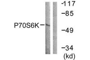 Western Blotting (WB) image for anti-Ribosomal Protein S6 Kinase, 70kDa, Polypeptide 1 (RPS6KB1) (AA 195-244) antibody (ABIN2888683) (RPS6KB1 Antikörper  (AA 195-244))