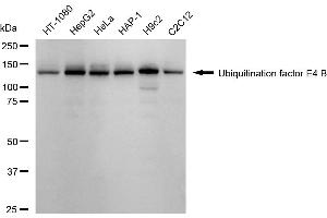 Western blotting analysis using Ubiquitination factor E4 B antibody (ABIN7800713). (Rekombinanter UBE4B Antikörper)