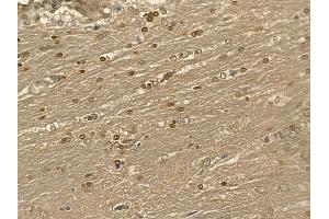 LBX1 Mouse Monoclonal Antibody at 1/100 staining rat brain tissue by IHC-P. (Lbx1 Antikörper)
