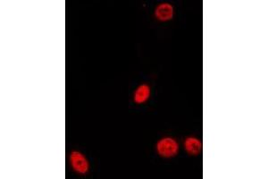 ABIN6275533 staining Hela by IF/ICC. (PDIK1L Antikörper  (Internal Region))