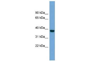 Western Blotting (WB) image for anti-ATPase, Na+/K+ Transporting, beta 4 Polypeptide (ATP1B4) (Middle Region) antibody (ABIN2782764)