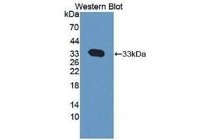Western blot analysis of the recombinant protein. (CAPNL1 Antikörper  (AA 75-356))