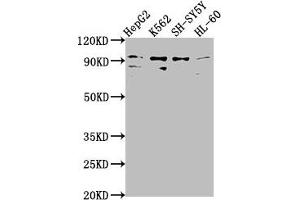 Western Blot Positive WB detected in: HepG2 whole cell lysate, K562 whole cell lysate, SH-SY5Y whole cell lysate, HL-60 whole cell lysate All lanes: NUGGC antibody at 1:2000 Secondary Goat polyclonal to rabbit IgG at 1/50000 dilution Predicted band size: 92 kDa Observed band size: 92 kDa (C8orf80 Antikörper  (AA 1-228))