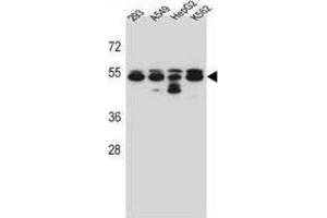 Western Blotting (WB) image for anti-Tubulin, beta 8 (TUBB8) antibody (ABIN2997238) (Tubulin, beta 8 Antikörper)
