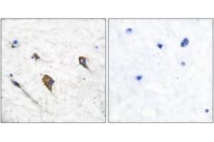 Immunohistochemistry (IHC) image for anti-Colony Stimulating Factor 2 Receptor, beta 2 (CSF2RB2) (AA 559-608), (pTyr593) antibody (ABIN1531288)