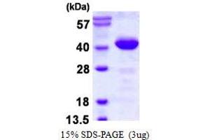 Image no. 1 for Phosducin-Like (PDCL) (AA 1-301) protein (His tag) (ABIN6386983)