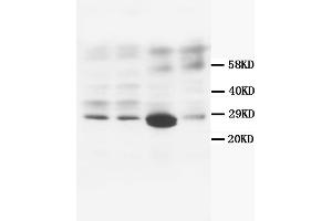 Western Blotting (WB) image for anti-Calbindin (CALB1) antibody (ABIN1105634)