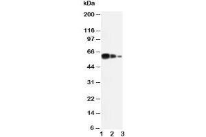 Western blot testing of ADAM10 antibody and Lane 1:  recombinant human protein 10ng;  2: 5ng;  3:  2. (ADAM10 Antikörper  (C-Term))