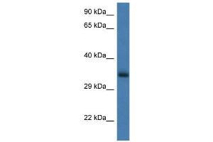 WB Suggested Anti-Gnpda1 Antibody   Titration: 1. (GNPDA1 Antikörper  (N-Term))