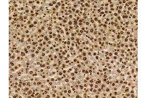 Phospho-SGK1 (Ser78) Antibody at 1/100 staining Rat liver tissue by IHC-P.