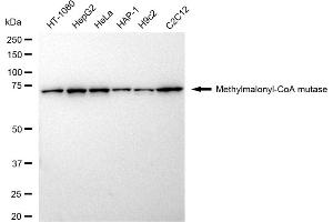 Western blotting analysis using Methylmalonyl-CoA mutase antibody (ABIN7799395). (Rekombinanter MUT Antikörper)