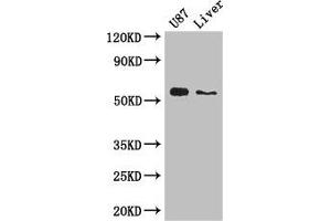 Western Blot Positive WB detected in: U87 whole cell lysate, Mouse liver tissue All lanes: ALDH1A3 antibody at 3 μg/mL Secondary Goat polyclonal to rabbit IgG at 1/50000 dilution Predicted band size: 57 kDa Observed band size: 57 kDa (ALDH1A3 Antikörper  (AA 2-210))