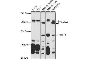 Western blot analysis of extracts of various cell lines, using CDKL3 antibody (ABIN7266612) at 1:1000 dilution. (CDKL3 Antikörper  (AA 1-120))