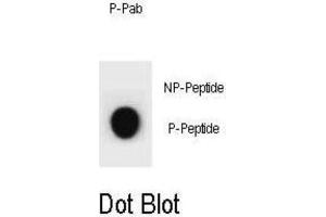Dot Blot (DB) image for anti-Cyclin B2 (CCNB2) (pSer392) antibody (ABIN3002074) (Cyclin B2 Antikörper  (pSer392))