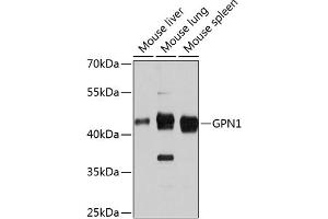 Western blot analysis of extracts of various cell lines, using GPN1 antibody (ABIN6133308, ABIN6141341, ABIN6141342 and ABIN6215758) at 1:3000 dilution. (GPN1 Antikörper  (AA 269-388))