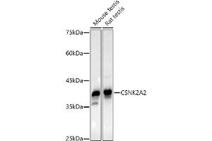 Western blot analysis of extracts of various cell lines, using CSNK2 antibody (0791) at 1:1000 dilution. (CSNK2A2 Antikörper)