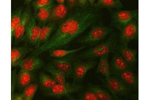 IF analysis of Daxx using anti-Daxx antibody (ABIN3043822) and anti-Tubulin Alpha antibody (ABIN7600339). (DAXX Antikörper  (AA 56-345))