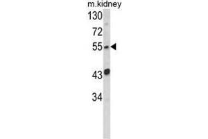 Western blot analysis of SIL1 Antibody (Center) in mouse kidney tissue lysates (35ug/lane). (SIL1 Antikörper  (Middle Region))
