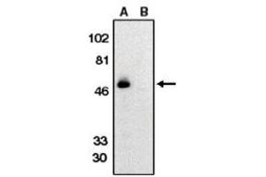 Image no. 1 for anti-Chemokine (C-X3-C Motif) Receptor 1 (CX3CR1) (AA 175-189) antibody (ABIN265002) (CX3CR1 Antikörper  (AA 175-189))