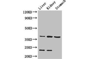 Western Blot Positive WB detected in: Mouse liver tissue, Mouse kidney tissue, Mouse stomach tissue All lanes: Akr1a1 antibody at 2. (AKR1A1 Antikörper  (AA 2-325))