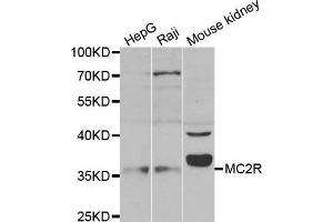 Western blot analysis of extracts of 293 cell lysate, using MC2R antibody. (MC2R Antikörper)