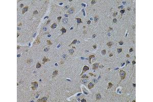 Immunohistochemistry of paraffin-embedded Rat brain using ERBB3 Polyclonal Antibody at dilution of 1:100 (40x lens). (ERBB3 Antikörper)