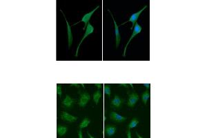 ICC/IF analysis of CSTB in U87MG cells line, stained with DAPI (Blue) for nucleus staining and monoclonal anti-human CSTB antibody (1:100) with goat anti-mouse IgG-Alexa fluor 488 conjugate (Green). (CSTB Antikörper  (AA 1-98))
