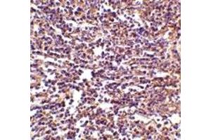 Immunohistochemistry (IHC) image for anti-CD180 Molecule (CD180) (Middle Region) antibody (ABIN1031073) (CD180 Antikörper  (Middle Region))