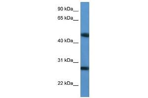 Western Blot showing TM2D2 antibody used at a concentration of 1-2 ug/ml to detect its target protein. (TM2D2 Antikörper  (Middle Region))
