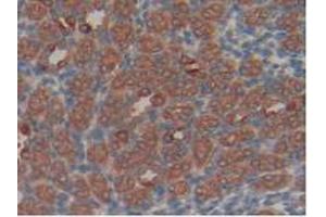 IHC-P analysis of Rat Kidney Tissue, with DAB staining. (Hexokinase 1 Antikörper  (AA 413-540))