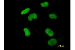 Immunofluorescence of purified MaxPab antibody to ZNF502 on HeLa cell. (ZNF502 Antikörper  (AA 1-544))