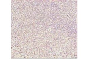 Immunohistochemistry of paraffin-embedded human tonsil tissue using ABIN7144962 at dilution of 1:100 (DDX11 Antikörper  (AA 1-220))
