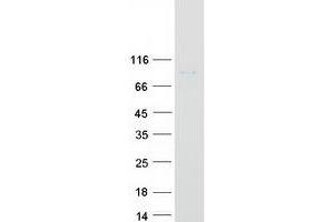 Western Blotting (WB) image for Hepatocyte Growth Factor (Hepapoietin A, Scatter Factor) (HGF) (Transcript Variant 1) protein (Myc-DYKDDDDK Tag) (ABIN2722630)