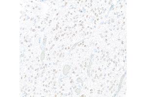 Immunohistochemistry (IHC) image for anti-SRY (Sex Determining Region Y)-Box 2 (SOX2) antibody (ABIN7449421) (SOX2 Antikörper)