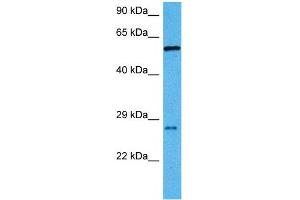 Host:  Mouse  Target Name:  RBPJ  Sample Tissue:  Mouse Liver  Antibody Dilution:  1ug/ml (RBPJ Antikörper  (C-Term))