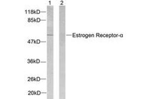 Western blot analysis of extracts from 293 cells, treated with Forskolin, using Estrogen Receptor-alpha (Ab-104) Antibody. (Estrogen Receptor alpha Antikörper  (AA 81-130))