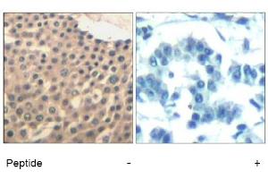 Image no. 1 for anti-HDAC4,HDAC5,HDAC9 (Ser220), (Ser246), (Ser259) antibody (ABIN319389) (HDAC4/HDAC5/HDAC9 Antikörper  (Ser220, Ser246, Ser259))