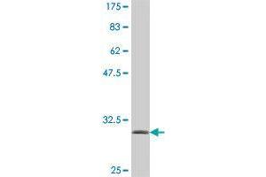 Western Blot detection against Immunogen (32. (GNRHR2 Antikörper  (AA 237-292))